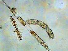 Mikroskopisk liv. Foto: Fiskeri- og Søfartsmuseet